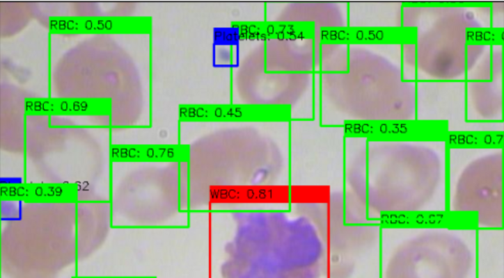 BloodCellDetection
