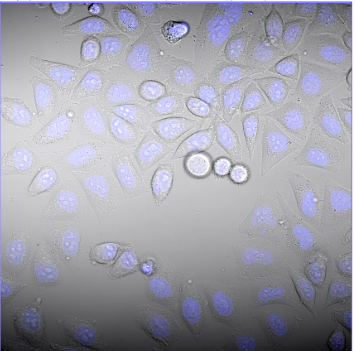 Cell Segmentation using AI