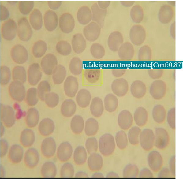 Malaria Parasite Detection Example 1