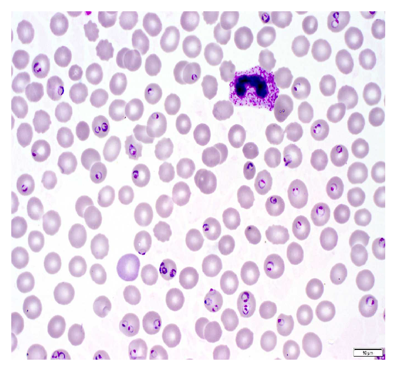 Malaria parasite detection